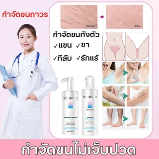 VIVXกําจัดขนน้องสาว ครีมกำจัดขน มูสกำจัดขน 100g คนท้องใช้ได้ อ่อนโยนต่อผิว ไม่มีร่องรอย กำจัดขนถาวร เรียบเนียนไม่เป