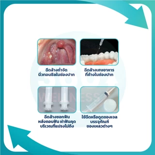 [360 Wellness ศูนย์รวมอุปกรณ์เพื่อสุขภาพ] ไซริงค์ กำจัดนิ่วทอนซิล หลอดฉีดยา ทันตกรรม ความจุ 12 มล.