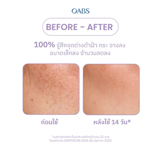 [1 ชิ้น] OABS เซรั่มฝ้า Anti Melasma Spotless Brightening Booster Serum ตัดวงจรฝ้า กระ จุดด่างดำ 15g