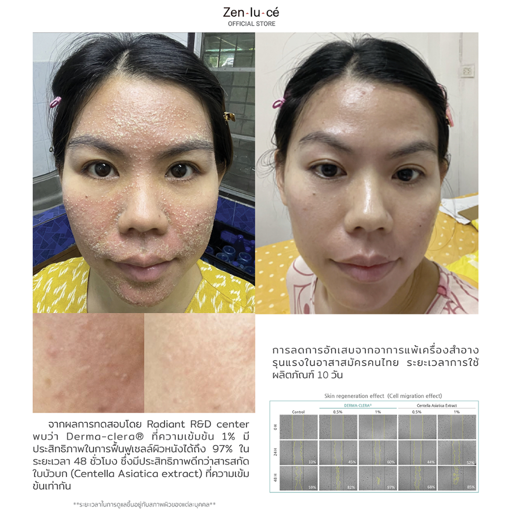 Zenluce Facial and body soothing care lotion  220 mL Premium - รูปที่ 3