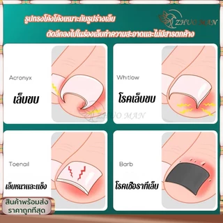 กรรไกรตัดเล็บ กรรไกรตัดหนัง กรรไกรตัดเล็บขบ ตัดเล็บขบได้ดี ทนทาน สตนเลสอย่างดี ใช้งานง่ายด้ามจับถนัดมือ