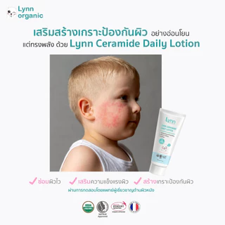 [รางวัลครีมกู้ผิวลูกแห่งปี2025] (โปร2 แถม 1เพียง 110 ) Lynn Organic Ceramide Daily Lotion โลชั่นบำรุงผิวเด็กพรีเมียม