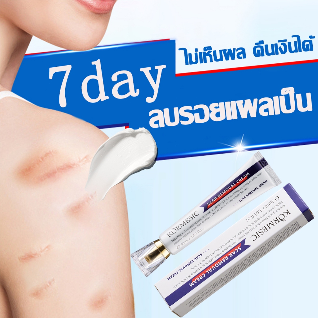 KORMESIC รอยแผลเป็น ครีมลบรอยแผลเป็น ครีมทาแผลเป็น เจลรอยแผลเป็น แผลผ่าตัด น้ำร้อนลวก ช่วยให้แผลเป็นหายไปอย่างสมบูรณ์