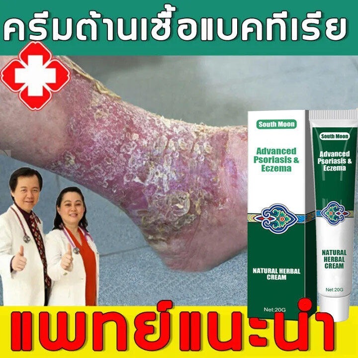 South Moon Skin Repair Cream บรรเทาอาการคันผิวหนัง แผลพุพอง Hand Foot Liss Antipuritic Care ครีมทาภายนอก