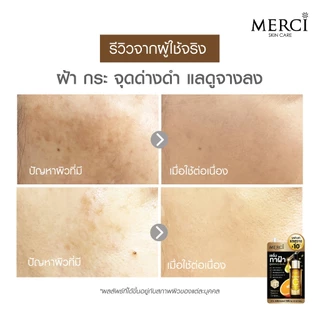 (1กล่องx6ซอง)Merci วิตซี เมอร์ซี่ ลดฝ้ากระ Merci Vitamin C Melasma & Dark Spot Serum