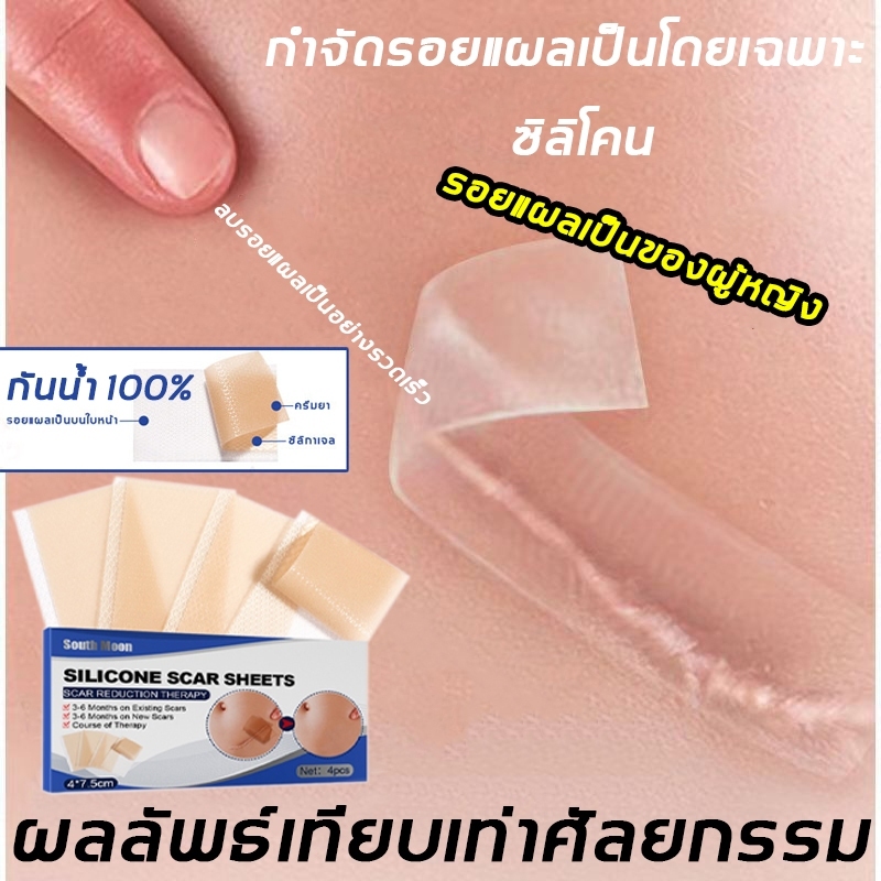 แผ่นยากำจัดแผลเป็นแผ่นแปะแบบมีเจลซิลิโคนรูปปีกท้องฟ้าใหม่สำหรับซ่อมแซมผิวหนังแผ่นแผลเป็นไหม้การบาดเจ็บ