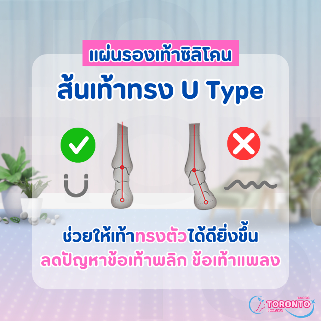 แผ่นรองเท้าซิลิโคน ส้นเท้าทรงตัว U ลดโอกาสเกิดข้อเท้าพลิก ข้อเท้าแพลง ช่วยการทรงตัวให้ดียิ่งขึ้น ราคา ถูกที่สุด ดีลบีเคเค แกลเลอรีภาพที่ 2