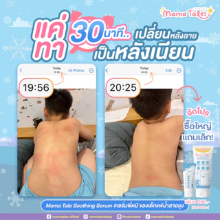 Exp 12/26 หลอดใหญ่ 40g. Mama Tales เซรั่มทาหลังยุงกัด ลดรอยแดง สำหรับเด็ก ใช้ได้ตั้งแต่แรกเกิด Soothing Serum