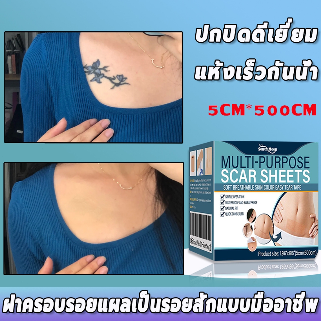 กําจัดรอยแผลเป็นจากแผลเป็น ✅เผยผิวเนียนสวย เทปปิดรอยสัก เทปปกปิดรอยแผลเป็น ปกปิดรอยแผเป็นจากสิว กันน้ํา ติดทนนาน