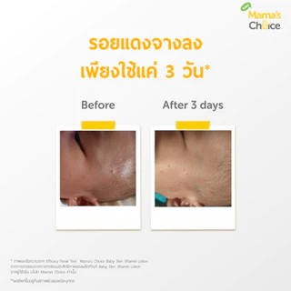 Mama's Choice โลชั่นบำรุงผิวเด็ก (100มล.) สารสกัดอะโวคาโด มะกอก เพิ่มความชุ่มชื้นอย่างอ่อนโยน | Baby Skin Vitamin Lotion