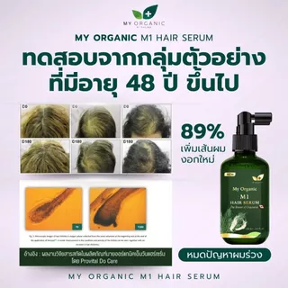 [โปรใหม่ก.ค.][ส่งฟรี] My Organic เซรั่มผมดำ ผมหงอก 20ML เบื่อย้อมผม สูตรออแกนิค แฮโทนิค บำรุงเส้นผม ผมร่วง ผมบาง ผมหงอก
