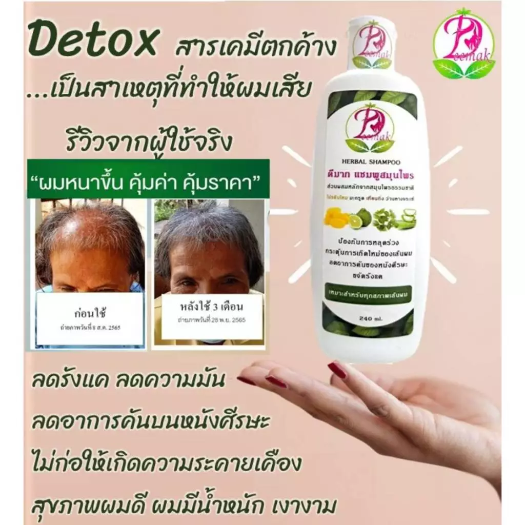 ดีมากแชมพูสมุนไพร บำรุงรากผมให้แข็งแรง ขจัดรังแค แก้อาการคันศีรษะ ดีมากสมุนไพร