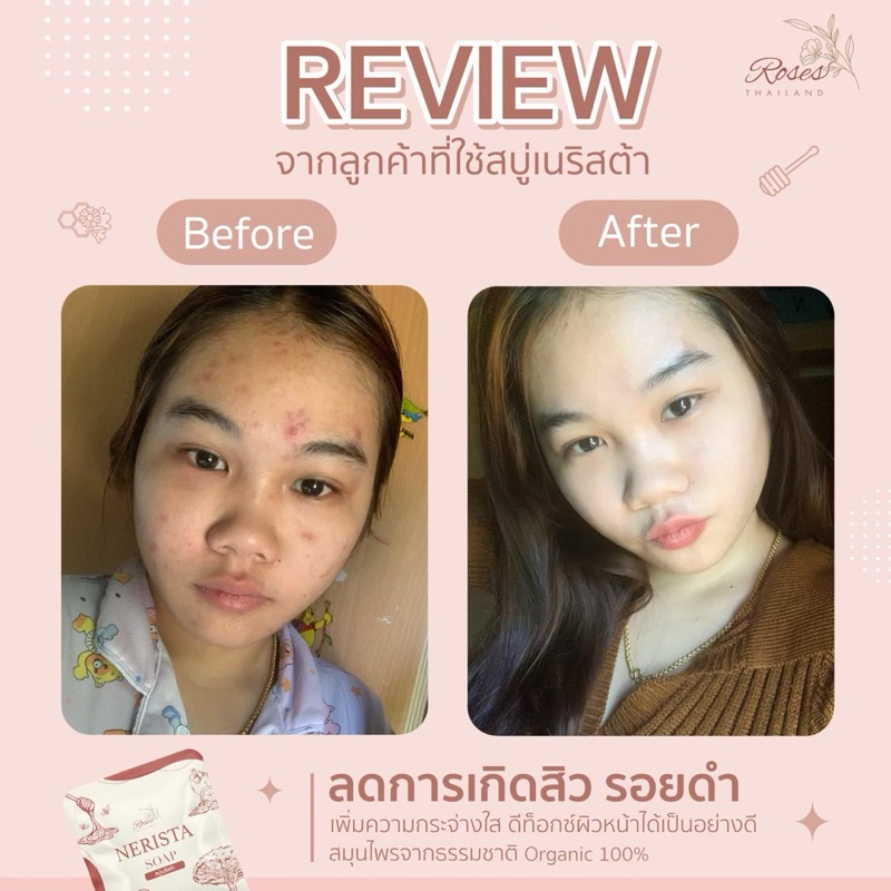 สบู่เนริสต้า🧸[ของแท้/ส่งไว] หน้าใส ลดสิว ลดผด ออแกนิก100% - รูปที่ 6