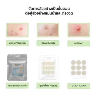 Shimanto แผ่นแปะสิว แผ่นดูดสิว 9ดวง ขนาด14mm มีสารบำรุง ลดการอักเสบ ลดรอยแดง ดูดสิวยุบไวทันใจ