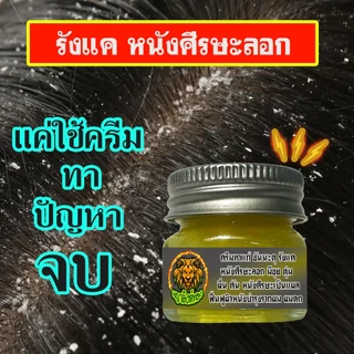 ช่วยหยุดอาการชันนะตุที่เป็นบนหัว หนังศรีษะลอก เป็นขลุย รังแค คันหัว คันหนังศรีษะ ด้วยครีมพญาสิงห์ทอง