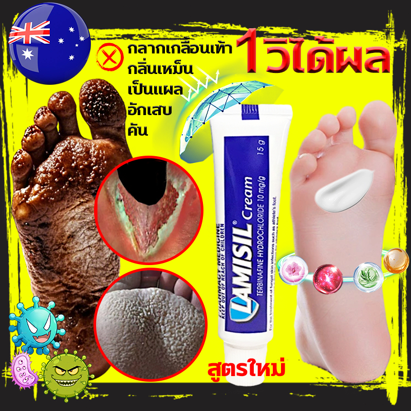 ได้ผลทันที! ครีมลดกลิ่นเท้า ครีมระงับกลิ่นเท้า ดับกลิ่นเท้า เท้าเหม็น ครีมทาเท้า กลิ่นเท้า ลดกลิ่นเท้า น้ํากัดเท้า foot