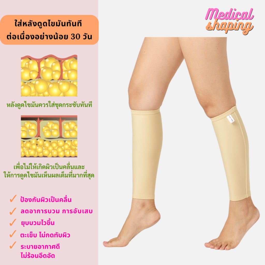 Medical shaping ปลอกน่องกระชับ หลังดูดไขมันน่อง กระชับน่อง ปลอกน่อง เกรดทางการแพทย์ ราคา ถูกที่สุด ดีลบีเคเค แกลเลอรีภาพที่ 4