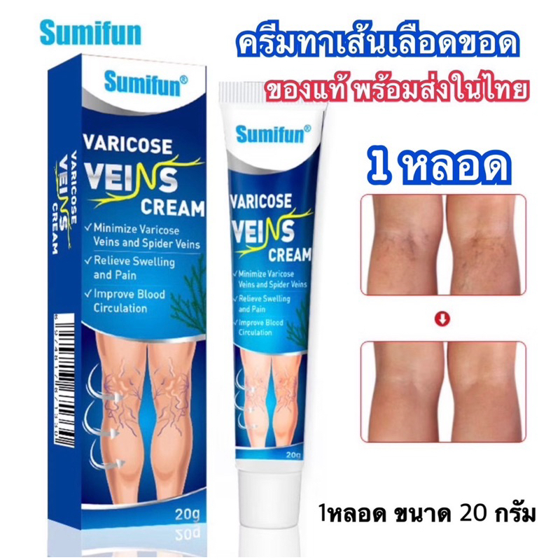 (พร้อมส่ง) ครีมทาเส้นเลือดขอด1หลอด