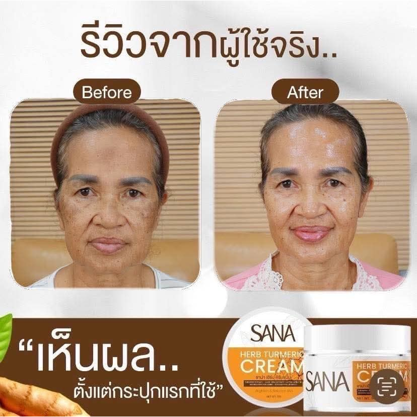 ครีมขมิ้นสด ครีมขมิ้น ซาน่า เฮิร์บ Sana Herb Turmeric Cream สูตรอ่อนโยน ผิวแพ้ง่ายใช้ได้ 5กรัม - รูปที่ 6