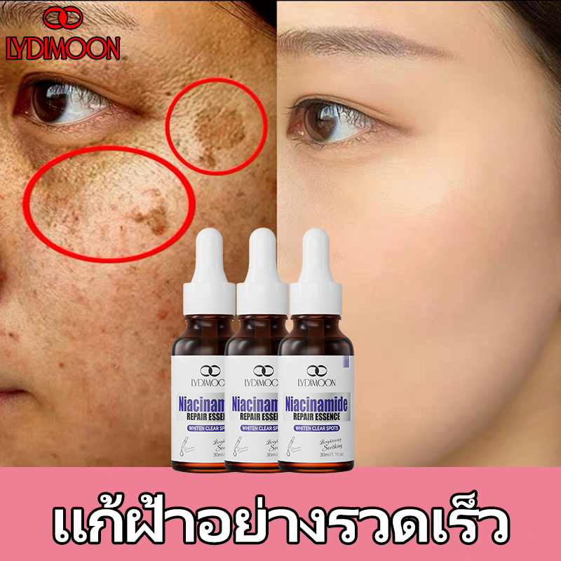 เซรั่มลดฝ้า ครีมทาฝ้า ครีมทาฝ้า 30ML กำจัดฝ้า จุดด่างดำ กระ ลบเมลานิน กระจ่างใสผิว ลดริ้วรอย ซ่อมแซมดูแลให้ผิวนุ่ม