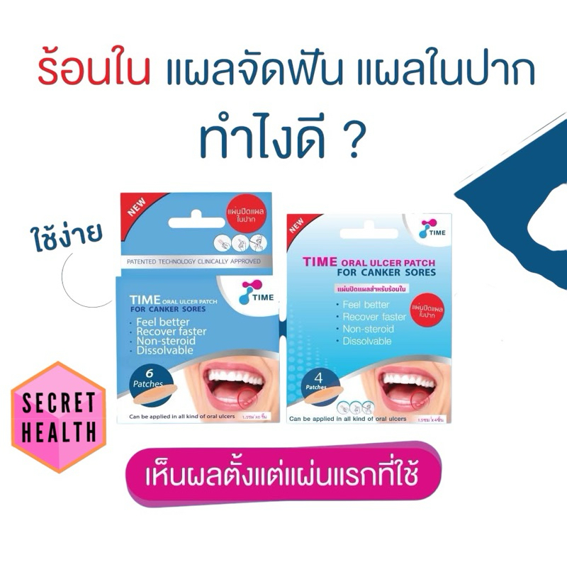 TIME Oral Ulcer Patch แผ่นปิดแผลในปาก แผลร้อนใน