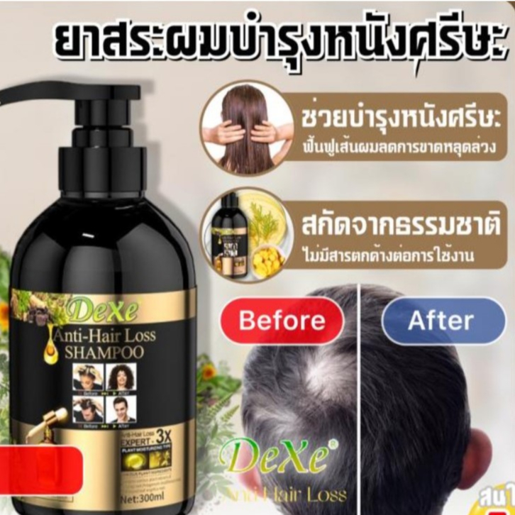 Dexe anti hair loss ยาสระผมบำรุงหนังศรีษะ