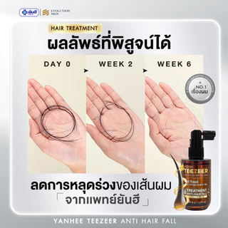 ยันฮี ทีเซอร์ เซรั่ม YANHEE TEEZEER SERUM เซรั่มลดผมร่วง กระตุ้นผมใหม่ ผม หนา สูตร ยันฮี sale