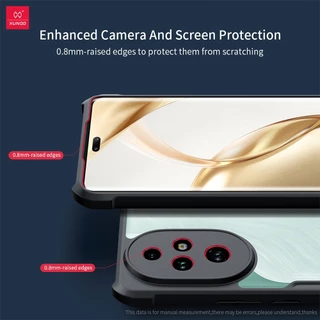 Xundd เคส ใช้สำหรับ Honor 200 Smart Case Honor X9d X7d Honor X7C เคสป้องกันการกันกระแทก วัสดุTPU+ฝาหลังอะคริลิคใ