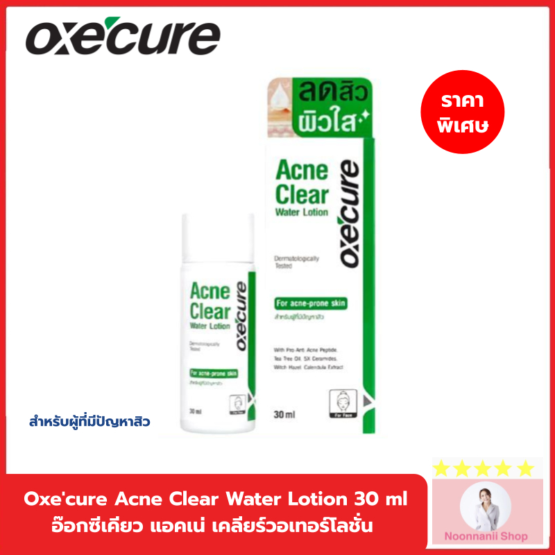 [NEW] Oxe'cure Acne Clear Water Lotion 30 ml อ๊อกซีเคียว แอคเน่ เคลียร์วอเทอร์โลชั่น (10OX00160)