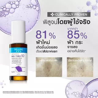 MizuMi Advance Nio-TXB3 Concentrate Serum 30 ml เซรั่มฝ้า สูตรเข้มข้น 10% ลดเลือนฝ้าหนา ฝ้าแดด จุดด่างดำ