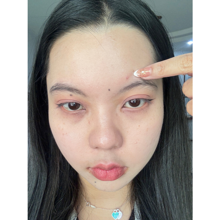 dermaAngel Salicyilc Acne Moon patch for Day 4 ชิ้น 4 กล่อง (ขนาดใหญ่พิเศษ) - รูปที่ 3