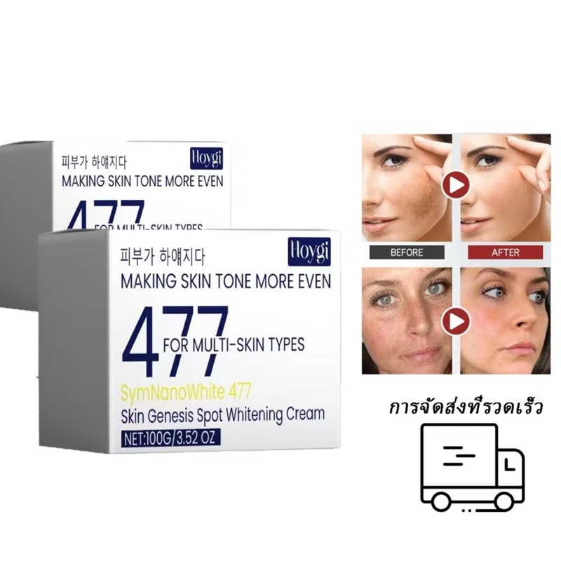ครีมทาหน้า ครีมไวท์เทนนิ่ง 477 ไวท์เทนนิ่งครีม แก้ฝ้าปรับให้ผิวขาว ปรับปรุงปัญหาผิวแห้งหมองคล้ำ