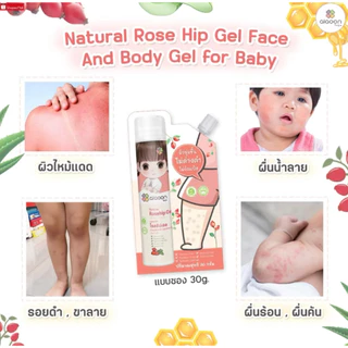 (ส่งด่วน/ส่งทันที🔥) ไออุ่น โรสฮิปเจล (AiaoonRosehip Gel for Face and Body) บำรุงผิวหน้าผิวกายเด็ก