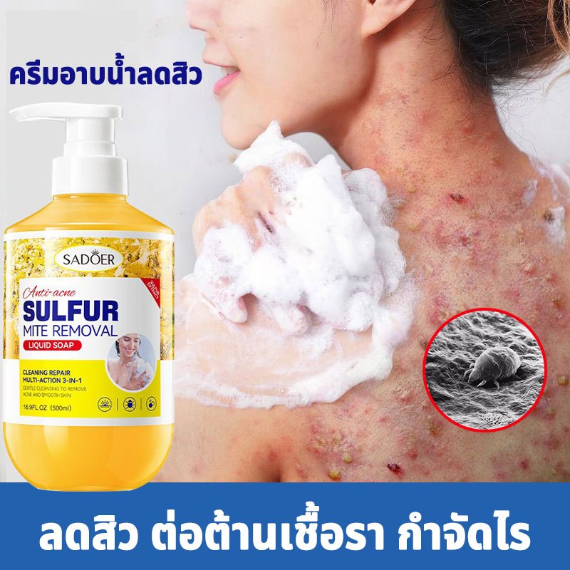 ครีมอาบน้ำลดสิว กำจัดไรเจลอาบน้ํา 500ml ต่อต้านเชื้อราแก้คัน ให้ความชุ่มชื้นอ่อนโยน กลิ่นหอมติดทน ลดสิว กำจัดไร คุมน้