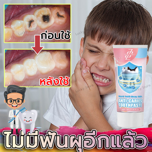 มีในสต๊อก ฟื้นฟูฟันผุอย่างมีประสิทธิภาพ ยาสีฟันฟลูออไรด์ช่วยลดคราบหินปูนและฟันขาว ฟื้นฟูฟันผุ เหมาะกับทุกคน
