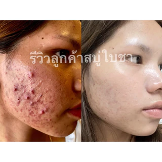 เซ็ท2ชิ้นสบู่ใบชา+เซรั่มใบชา สูตรแพทย์แผนไทย แถมตาข่ายตีฟอง
