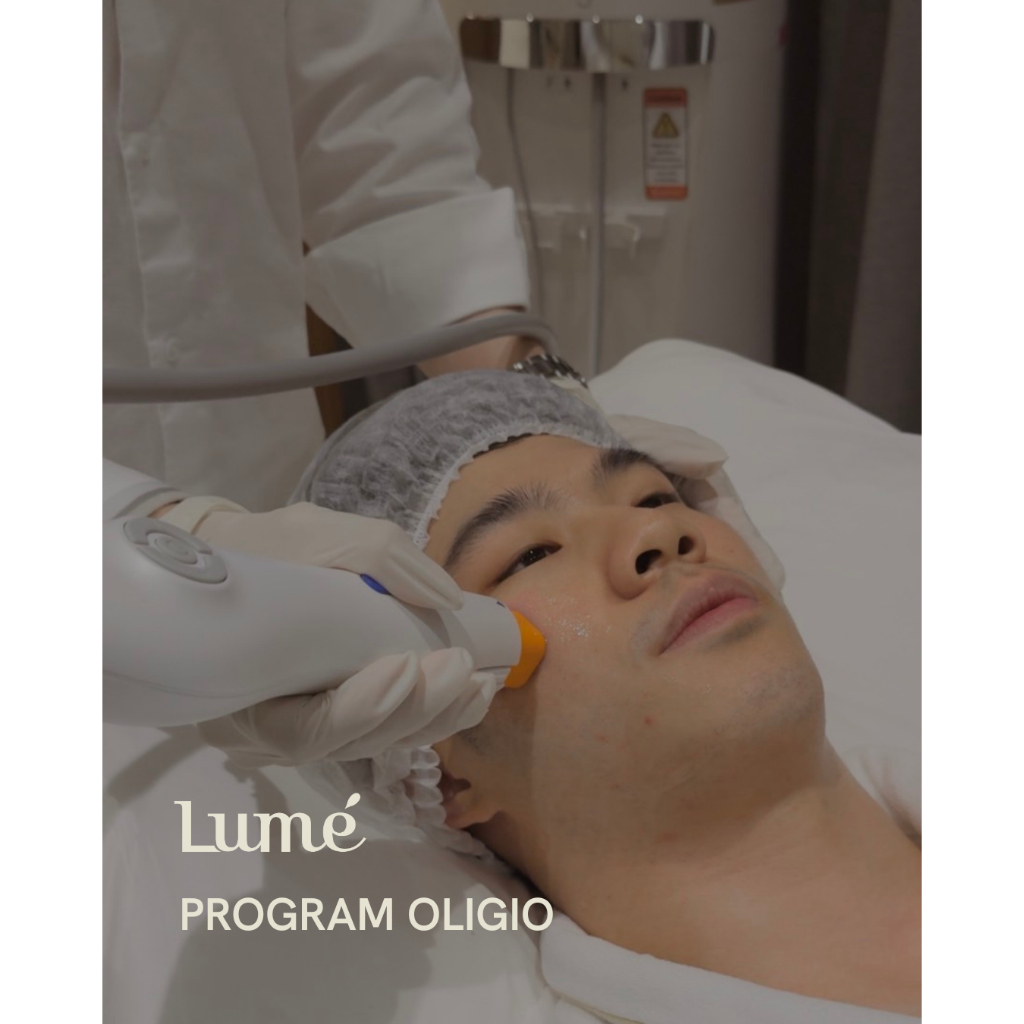 Program Oligio 600 Shots ยกกระชับ ปรับรูปหน้า