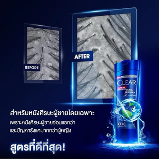 [ แพ็คคู่แชมพู ]🧊CLEAR ❄️เคลียร์ แชมพูขจัดรังแค 370 มล. แชมพู+แชมพู แชมพูเคลียร์ แชมพูขจัดรังแค บำรุงหนังศีรษะ ขวดปั๊ม