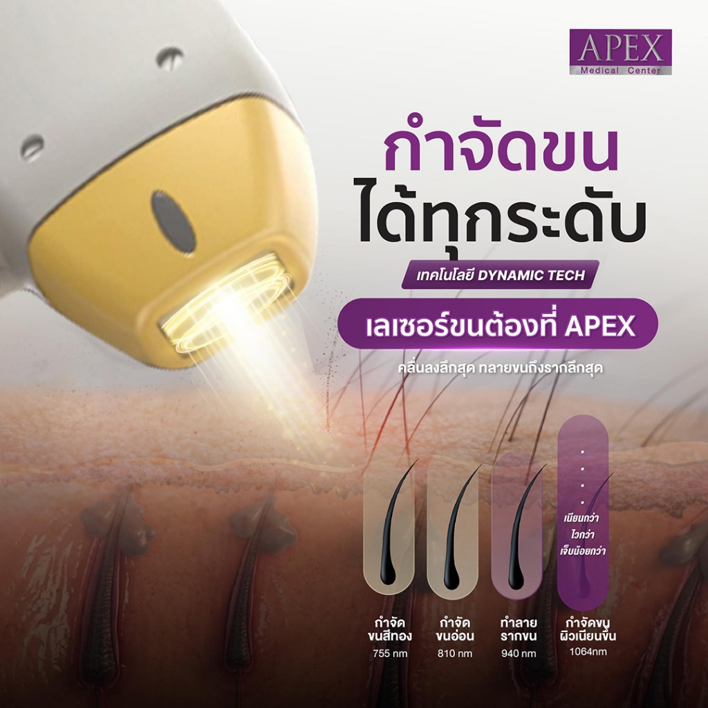 [E-Voucher] APEX เลเซอร์กำจัดขนขาล่าง ทั้งขา กำจัดลึกถึงราก เห็นผลไว ยิงลึกทุกชั้นขน ทดลอง (1 ครั้ง)