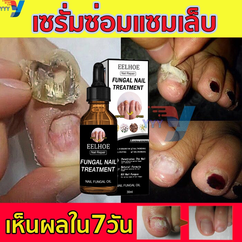 【ของแท้100%】EELHOE Nail Repair Essence Serum เซรั่มเล็บ เซรั่มซ่อมแซมเล็บ เซรั่มบำรุงเล็บ30ml