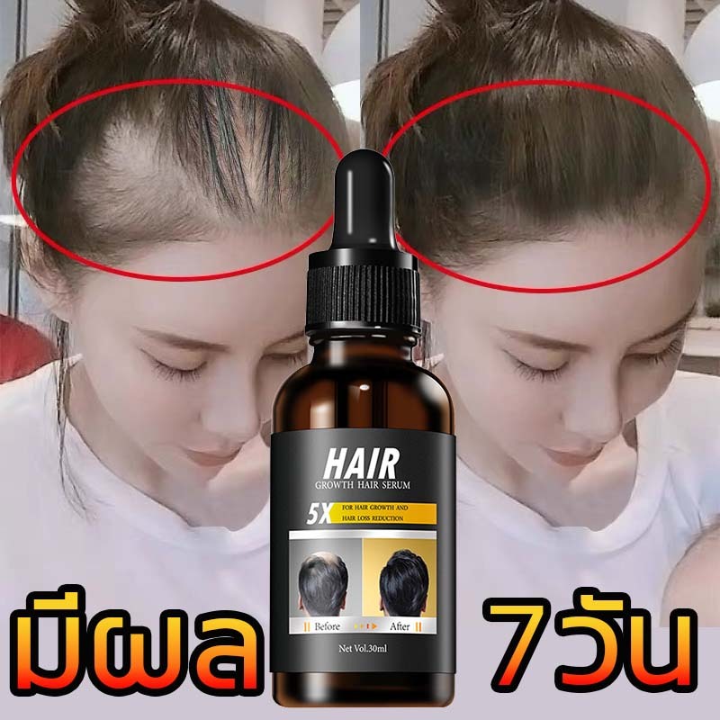 1 แถม 1แฮร์โทนิค HAIR เซรั่มปลูกผม ปลูกคิ้ว ปลูกหนวด สูตรเข้มข้น ขึ้นเร็ว ผมยาวไว ของแท้100%