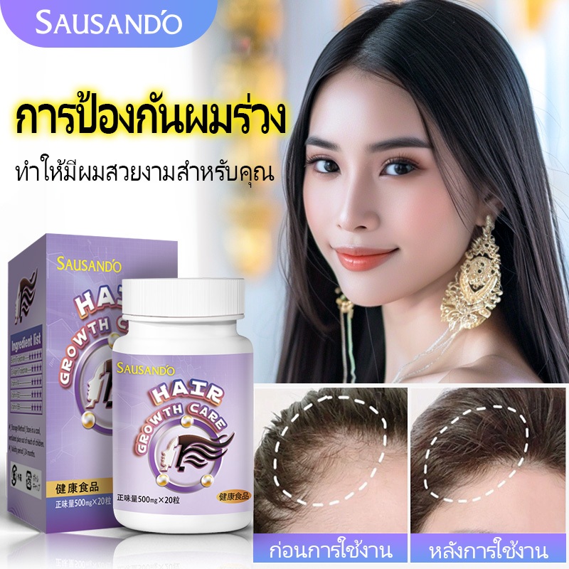 SAUSANDO การเจริญเติบโตของเส้นผมแคปซูล-ดูแลเส้นผม，ป้องกันผมร่วง，บำรุงเส้นผม