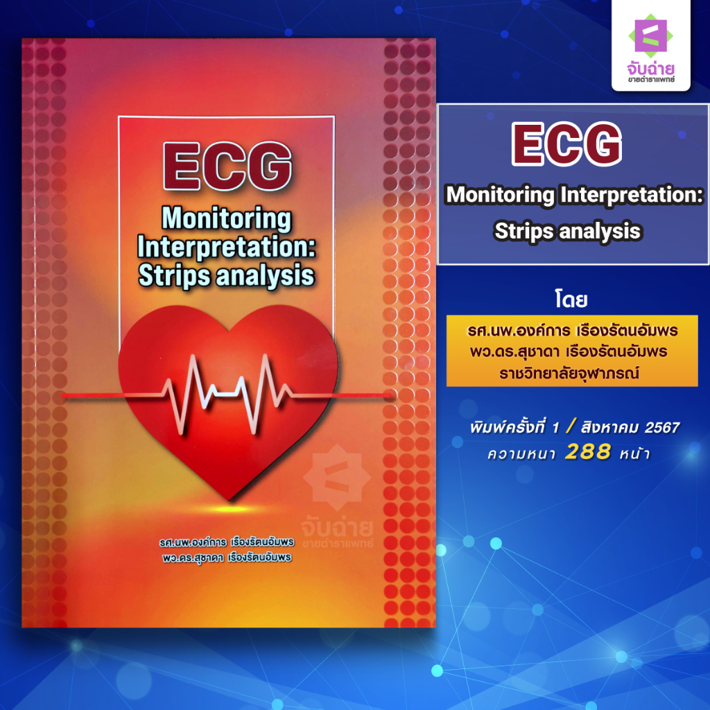 ECG Monitoring Interpretation: Strips analysis