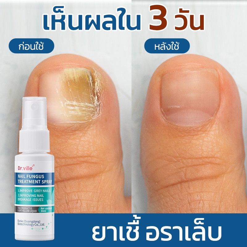 รักษาเชื้อราเล็บ DR.Ville Nail Care Fluid พร้อมส่ง บำรุงเล็บ ฟื้นฟูเล็บเสีย เล็บบาง เล็บฉีกขาด จากการทาสีเจล เคราติน