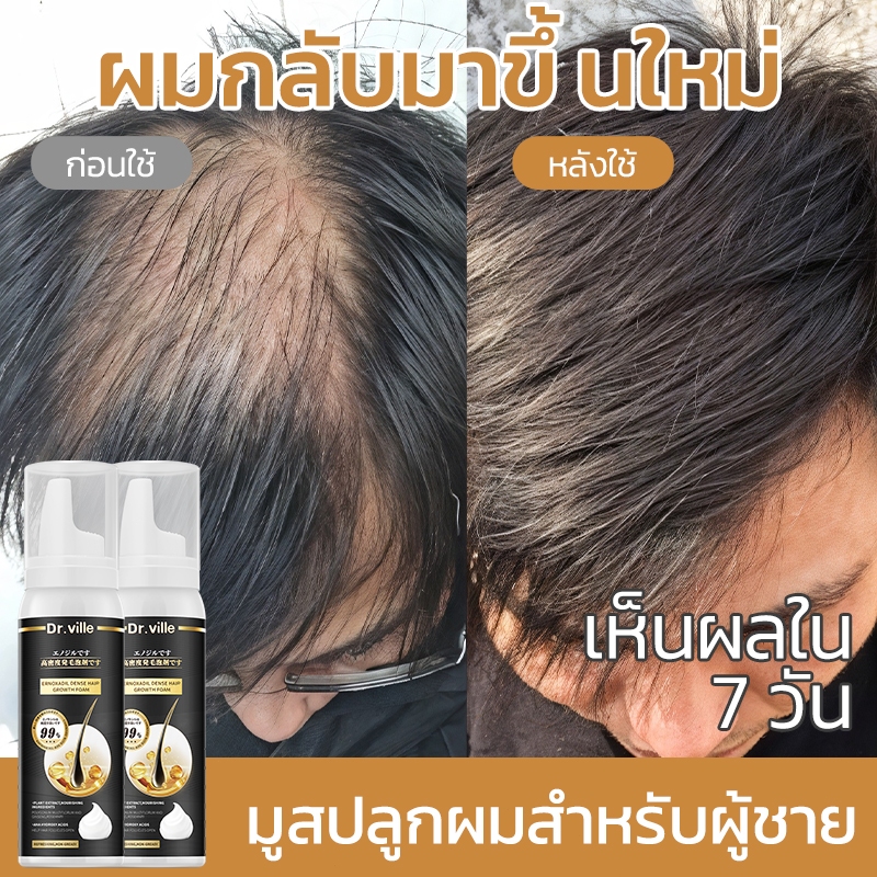 แชมพูลดผมร่วง Hair Growth Mousse 60ml เซรั่มปลูกผม เพิ่มวอลุ่ม สูตรเข้มข้น ขึ้นเร็ว ผมยาวไว