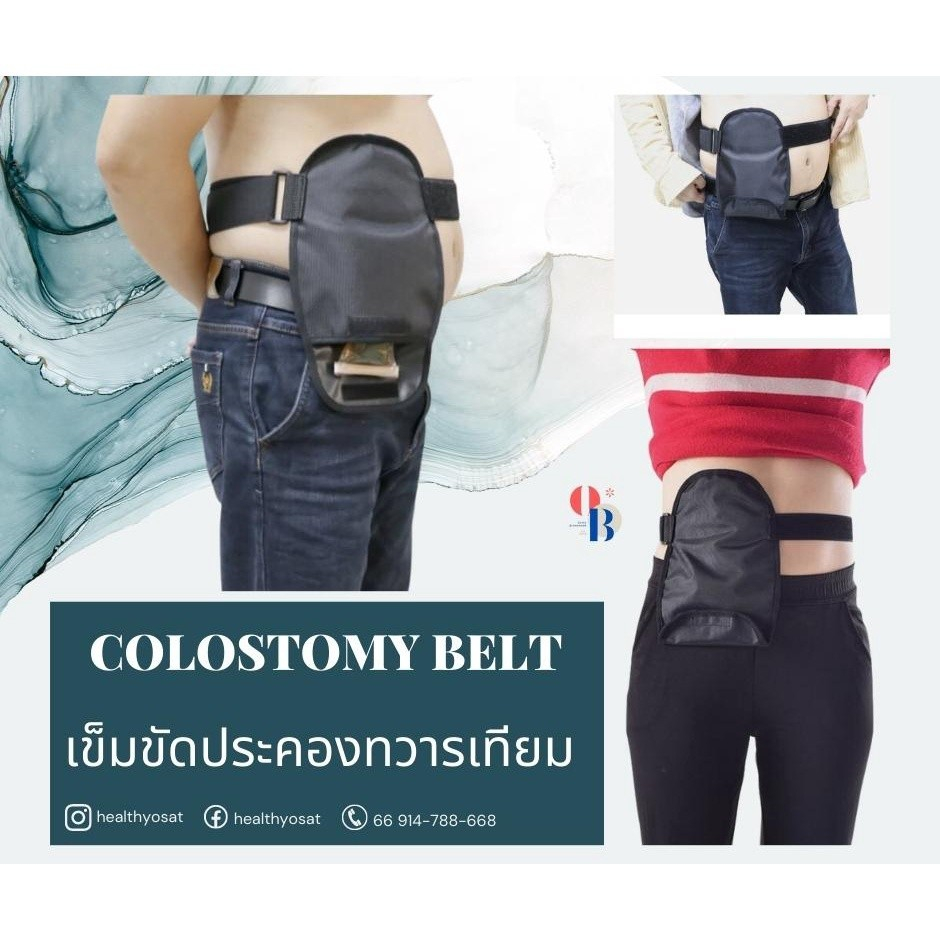 OB Brand เข็มขัดประคองทวารเทียม (Colostomy Belt) จัดส่งเร็วในไทย สำหรับผู้ที่มีถุงอุจจาระหน้าท้อง