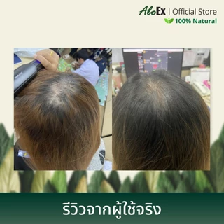 [รีวิวปัง] AloEx Original Shampoo 1 ขวดและ AloEx Hair Serum 50 ml. 1 ขวด เซตแชมพูและเซรั่มบำรุงผม ลดผมร่วงสำหรับผมมัน
