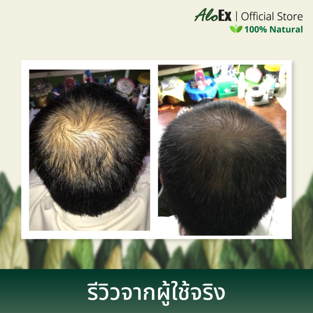 AloEx Hair Serum 120ml ขวดใหญ่ เซรั่มบำรุงหนังศีรษะและเส้นผม ลดผมร่วง สร้างผมใหม่ รากผมแข็งแรง เพิ่มผมหนา - รูปที่ 3