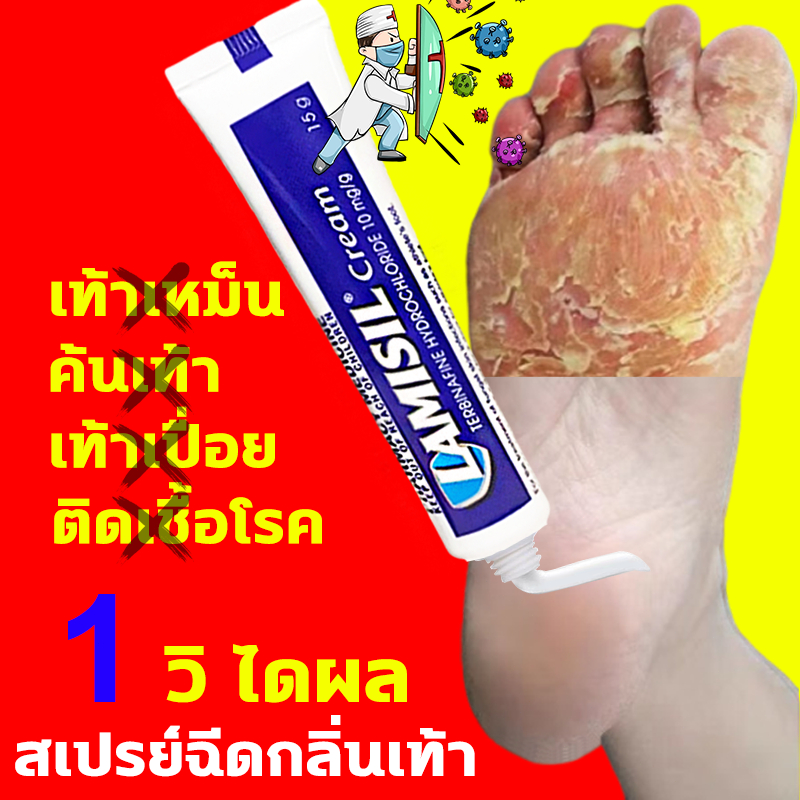 ได้ผล100% ครีมระงับกลิ่นเท้า ครีมทาเท้า ลดกลิ่นเท้า เท้าแตก ลดเหงื่อ รองเท้าเหม็น ดับกลิ่นเท้า ครีมดูแลเท้า