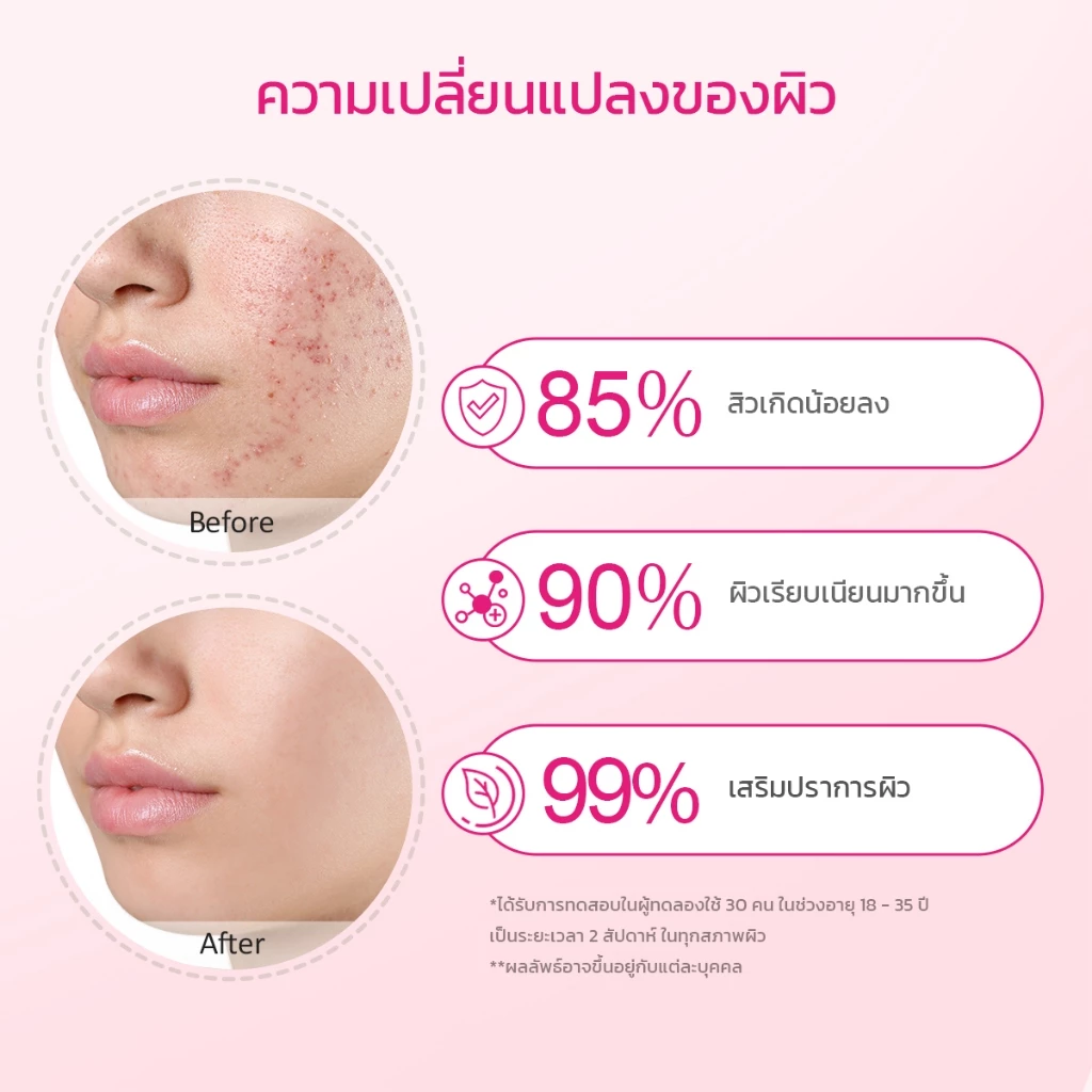 【Proxie's Pick】Glad2Glow Peach Retinol Serum แกลดทูโกลว์ พีช เรตินอล เซรั่ม เซรั่ม เซรั่มบำรุงผิวหน้า สกินแคร์หน้าใส thumbnail 3